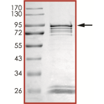 ALK (L1196M G1202R), Active
